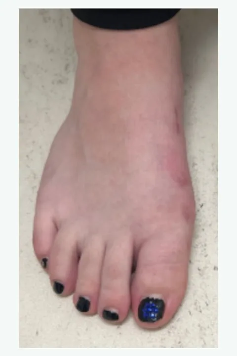 After: corrected alignment