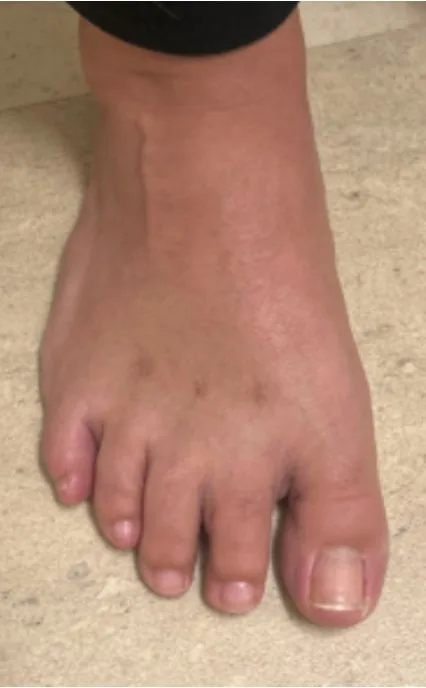 After: corrected alignment
