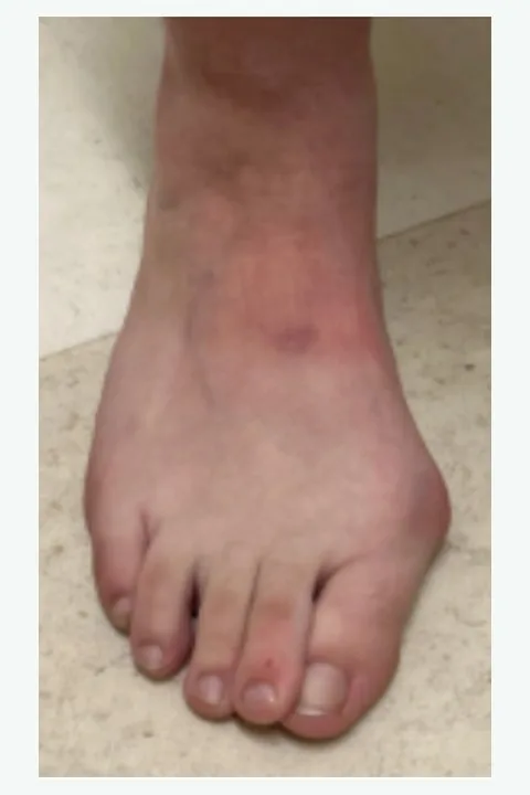 Before: deformity