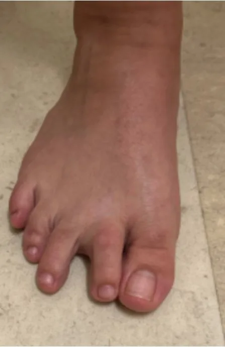 Before: deformity